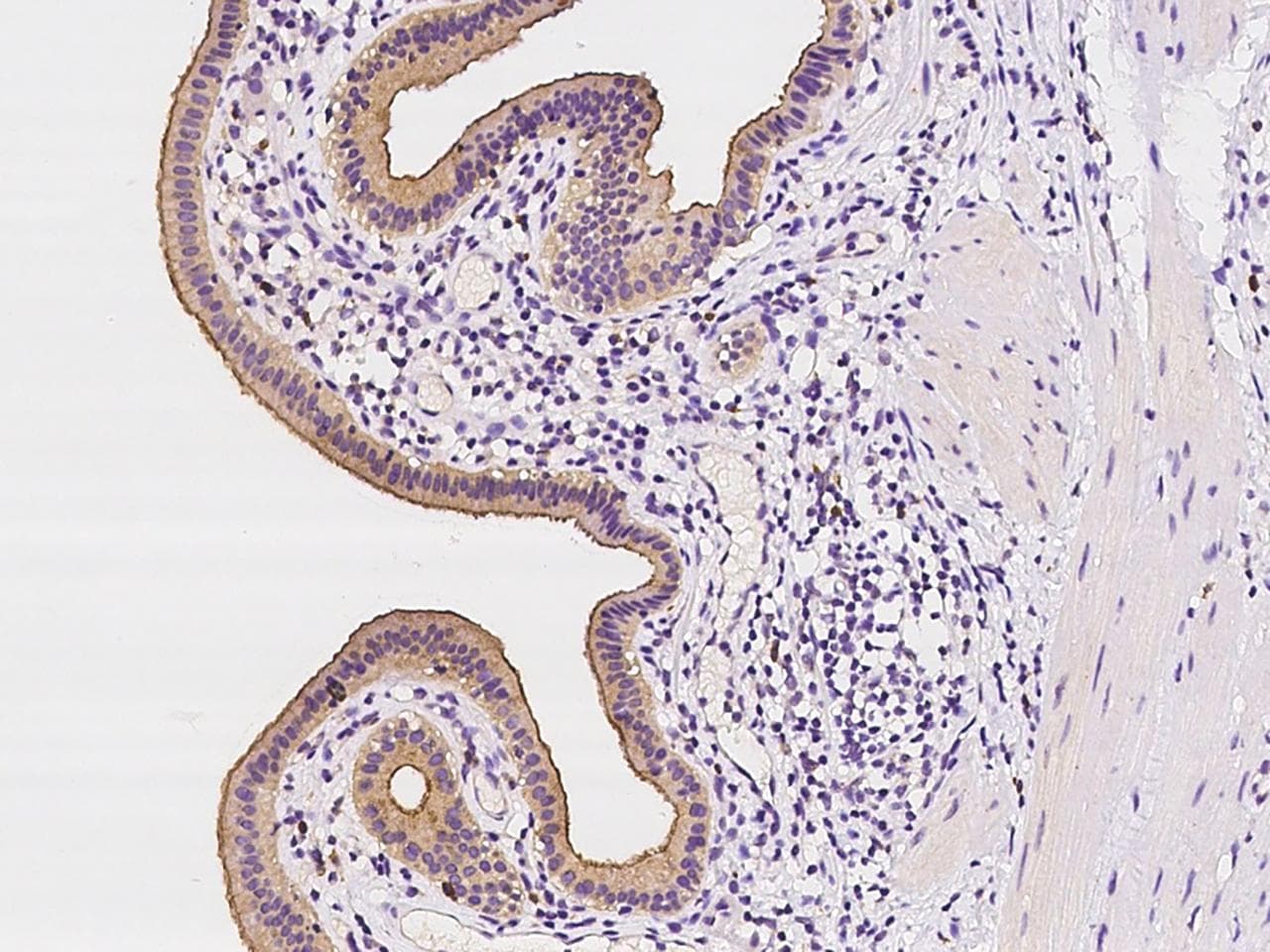 MLPH / Melanophilin Antibody