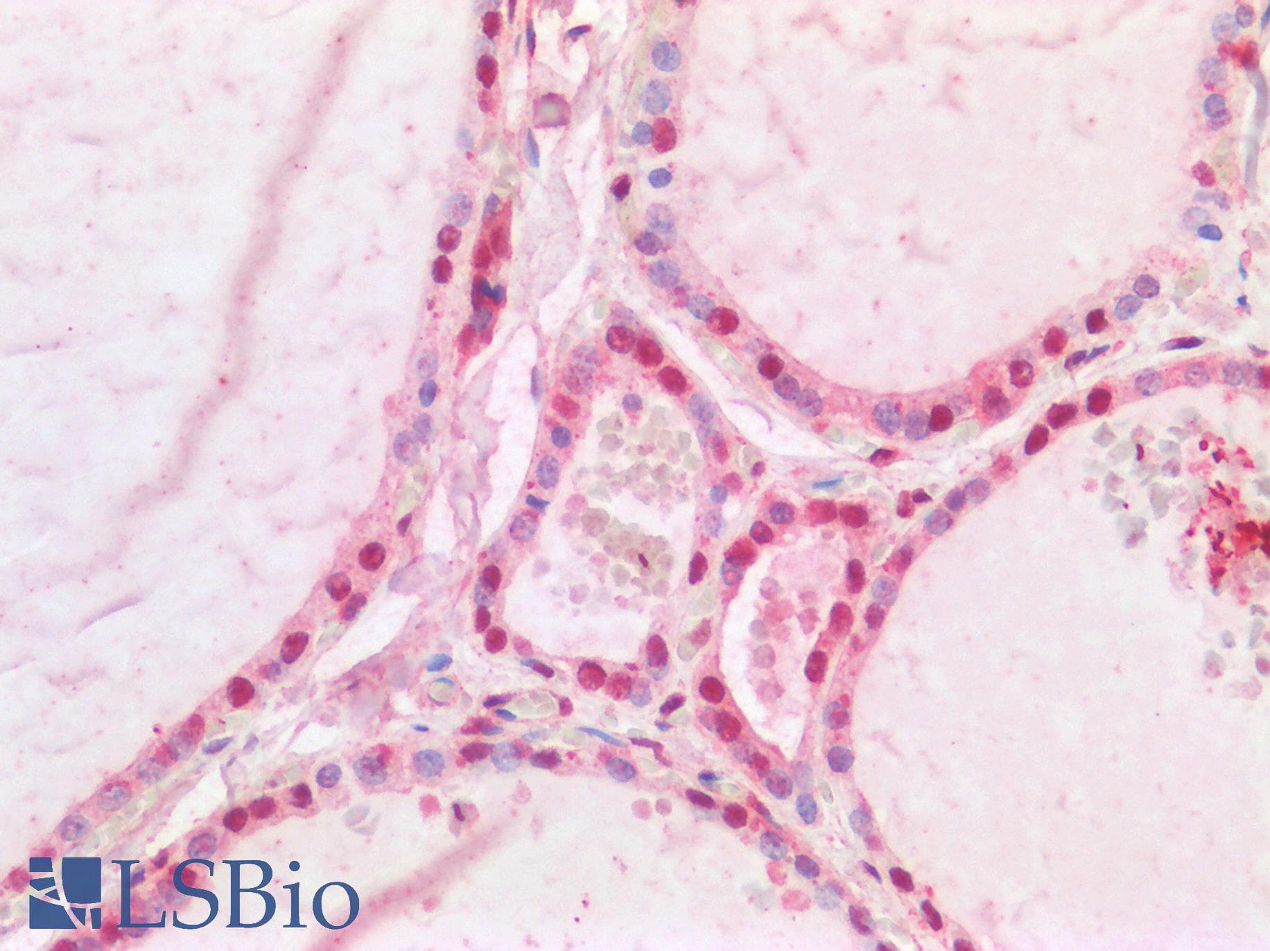 IHC-plus™ Polyclonal Goat anti-Human CREB1 / CREB Antibody (aa96-109, IHC, WB)