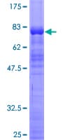 Human ZSCAN21 / Zipro1 Protein (Recombinant GST)