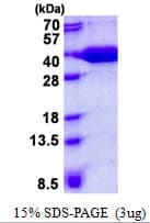 Human MPST Protein (Recombinant His)