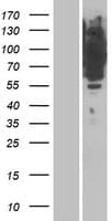 MRVI1 Protein (Over-Expression Lysate Myc-DDK (Flag))