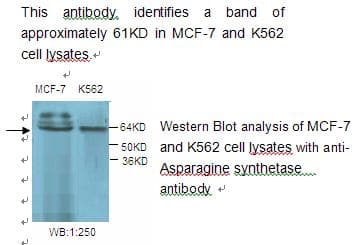 ASNS Antibody