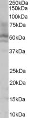 IHC-plus™ HNF4A / HNF4 Antibody (aa2-15)