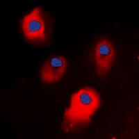 Polyclonal Rabbit anti-Human TSAP6 / STEAP3 Antibody (C-Terminus, IHC, IF, WB)