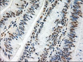 Monoclonal Mouse anti-Human MYC / c-Myc Antibody (clone OTI1A6, IHC, IF, WB)