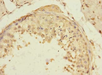 TIGD4 Antibody