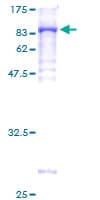 Human NMT2 Protein (Recombinant GST)