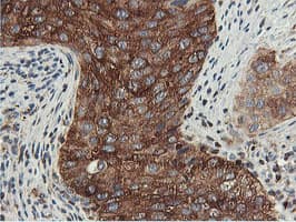 PFKP Antibody (clone OTI1A11)