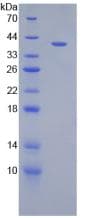 Rat MIP2 / GRO2 / CXCL2 Protein (Recombinant His-GST, N-terminus)