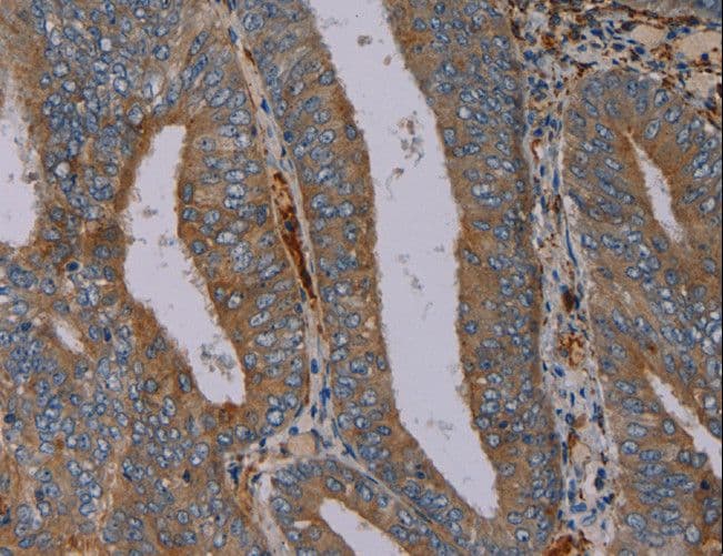 Peptide YY / PYY Antibody