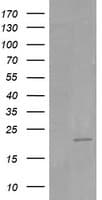 Monoclonal Mouse anti-Human HRAS / H-Ras Antibody (clone OTI1A1, IHC, IF, WB)