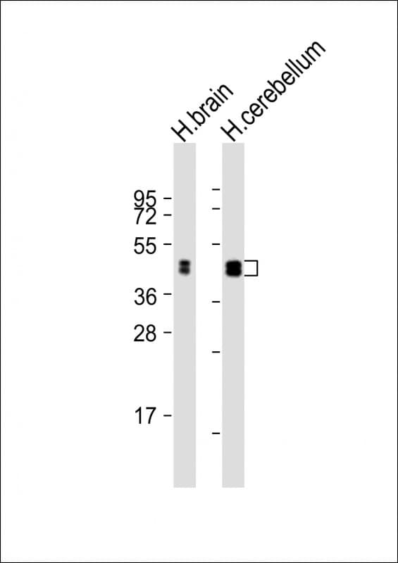 CNPase Antibody (aa122-156)