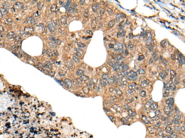PPP3R1 / Calcineurin B Antibody