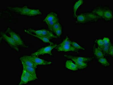 IHC-plus™ Polyclonal Rabbit anti-Human CCL2 / MCP1 Antibody (IHC, WB)