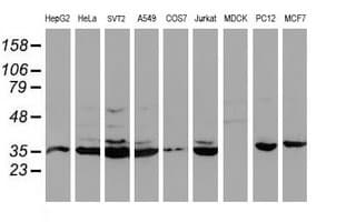 CYP2A6 Antibody (clone OTI1D2)