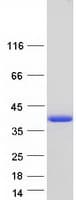 Human TPM1 / Tropomyosin Protein (Recombinant Myc-DDK (Flag))