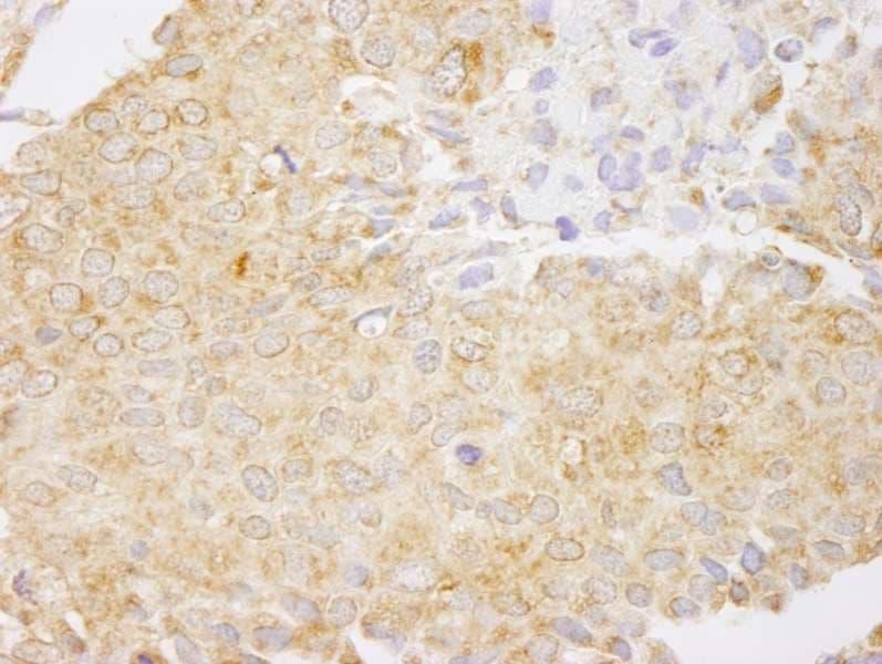NFKB1 / NF-Kappa-B Antibody (aa918-968)