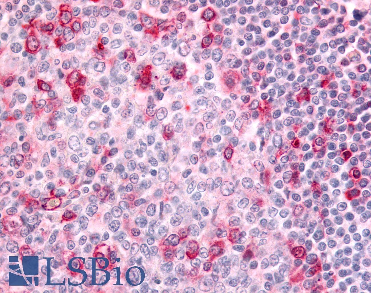 IHC-plus™ GPR183 / EBI2 Antibody (C-Terminus)