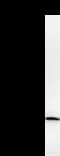 Monoclonal Mouse anti-Human TIP49 / RUVBL1 Antibody (clone 2943C1a, IF, WB)