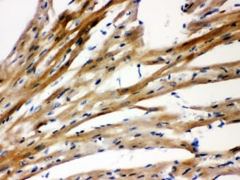 PSEN2 / Presenilin 2 Antibody (aa39-51)