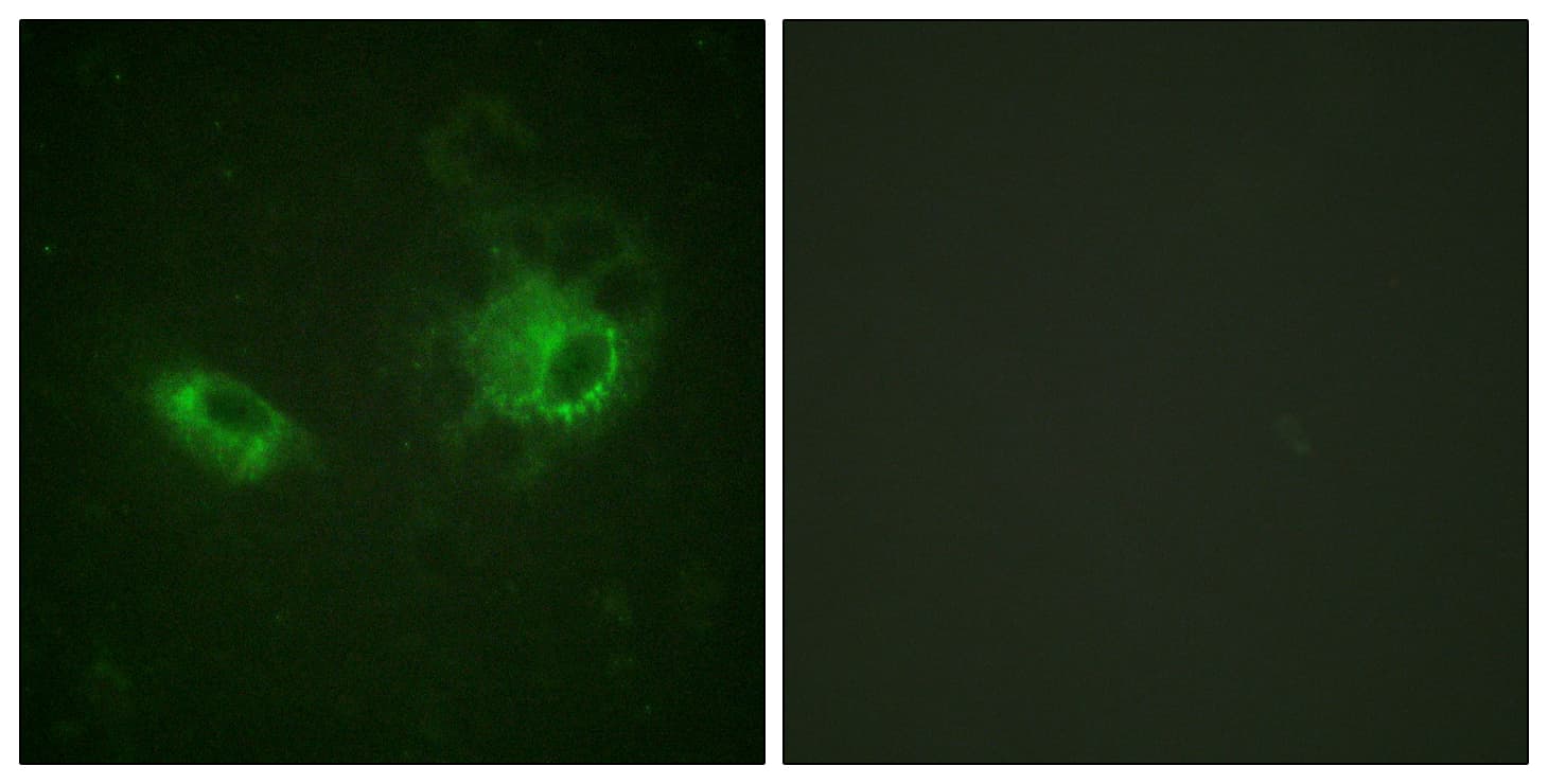 Polyclonal Rabbit anti-Human PDGFRB / PDGFR Beta Antibody (aa981-1030, IHC, IF)