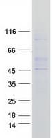 Human UGCG Protein (Recombinant Myc-DDK (Flag))