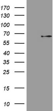 MAP3K8 / TPL2 Antibody (aa277-461, clone OTI2E10)