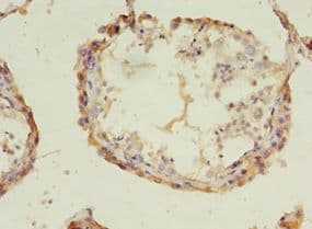 ACOT9 Antibody