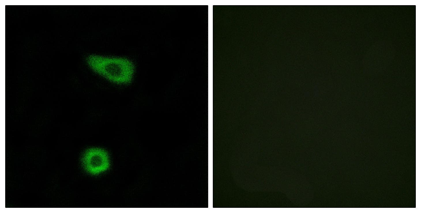 TNFAIP2 Antibody