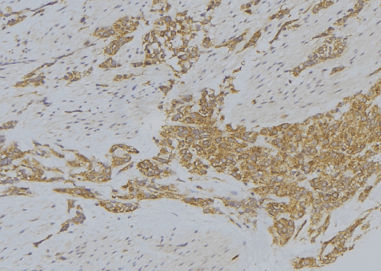 Polyclonal Rabbit anti-Human SRXN1 Antibody (IHC, WB)