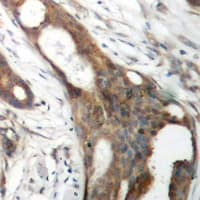 SLC1A4 / ASCT1 Antibody