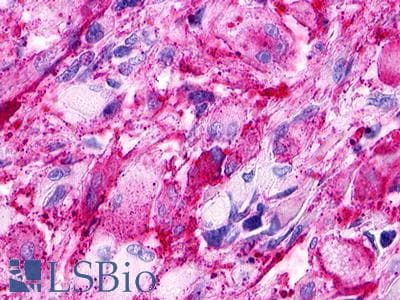 PathPlus™ Polyclonal Rabbit anti-Human GPR173 / SREB3 Antibody (N-Terminus, IHC)