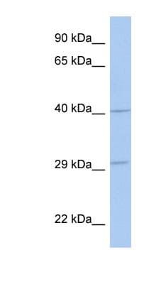 ART5 Antibody (aa215-264)