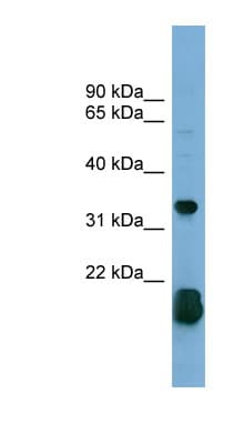 Polyclonal Rabbit anti-Human RHOF Antibody (aa107-156, WB)