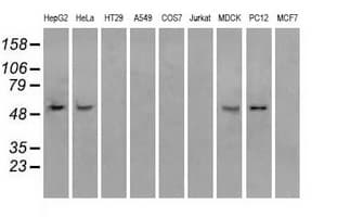 IHC-plus™ Monoclonal Mouse anti-Human ATP5B / ATP Synthase Beta Antibody (clone 6C10, IHC, WB)