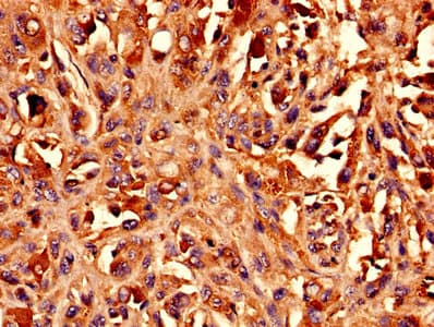 BCAT1 / ECA39 Antibody