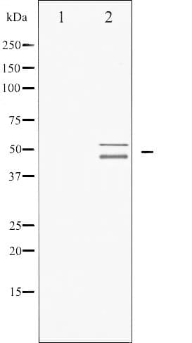 Polyclonal Rabbit anti-Human VASP Antibody (IHC, IF, WB)