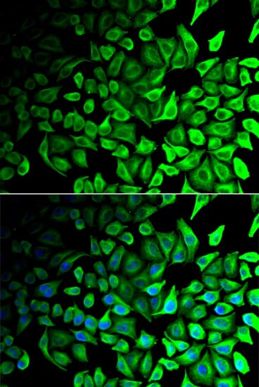 DPP2 / DPP7 Antibody