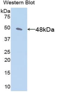 Aspartate Aminotransferase Antibody (aa1-413)