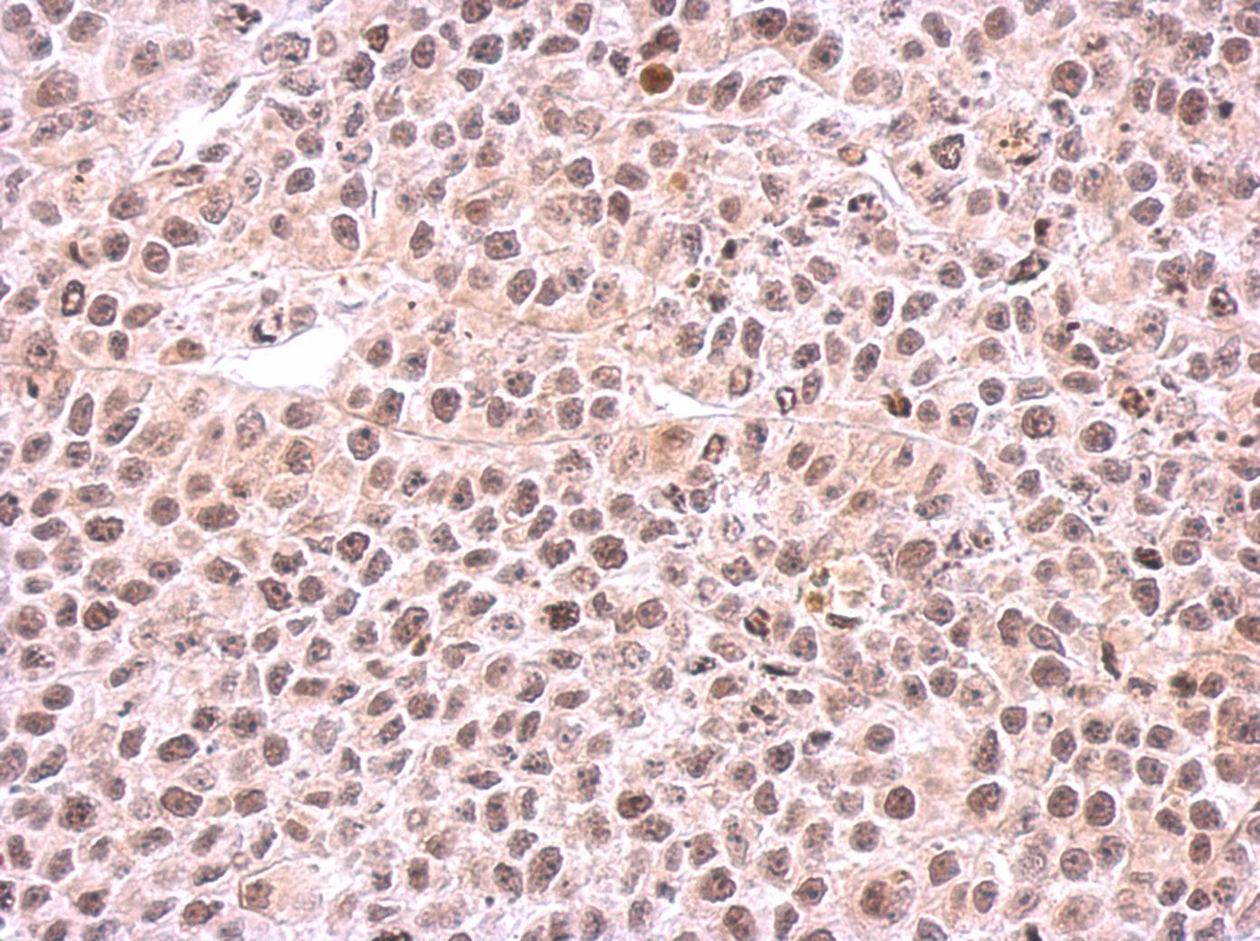 PSMC6 Antibody (aa1-301)