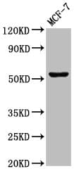 CHKA / CK / Choline Kinase Antibody