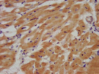 Polyclonal Rabbit anti-Human EYA1 Antibody (IF)