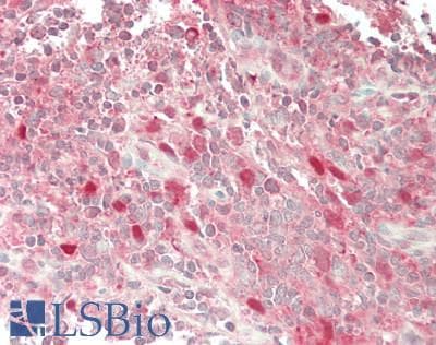 IHC-plus™ RAB7A / RAB7 Antibody