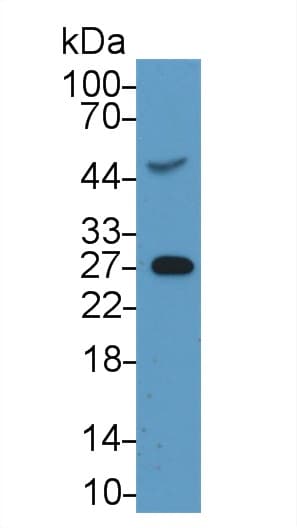 CRP / C-Reactive Protein Antibody (aa20-230, PE)