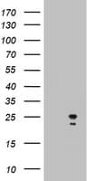 Monoclonal Mouse anti-Human ARFL3 / ARL3 Antibody (clone OTI5E6, aa2-182, WB)