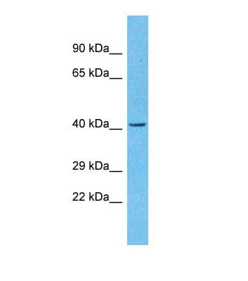 PARP12 Antibody (aa224-273)