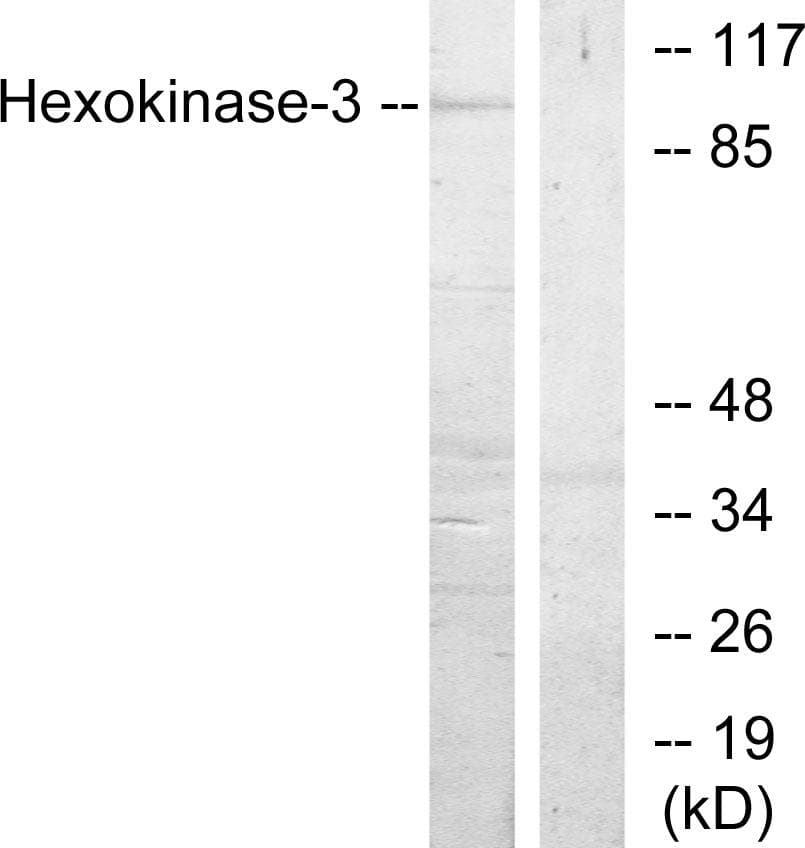 HK3 / Hexokinase 3 Antibody