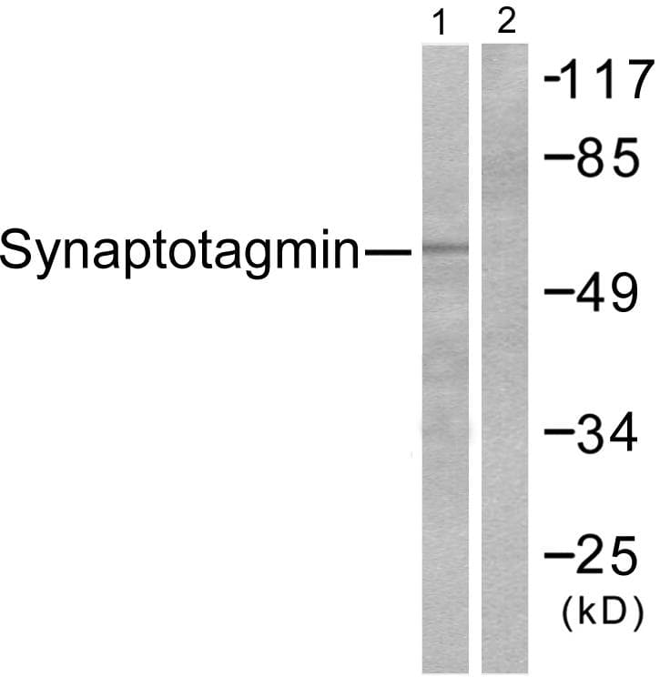 Polyclonal Rabbit anti-Human SYT1 / Synaptotagmin Antibody (p202, IHC, WB)