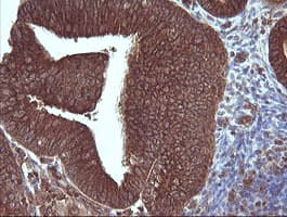 MAP2K3 / MEK3 / MKK3 Antibody (clone OTI2A7, Carrier-free)