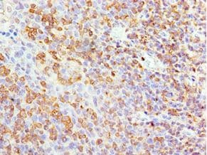 Polyclonal Rabbit anti-Human APBB1IP / RIAM Antibody (aa1-150, IHC, WB)